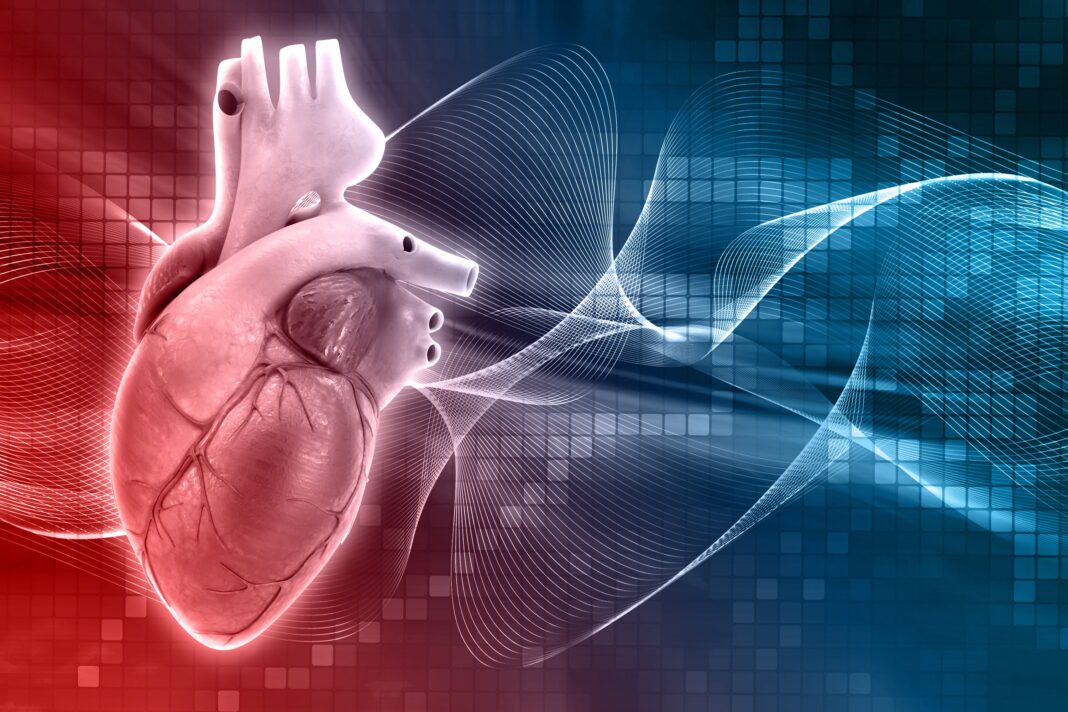 cardiomyopathie dilatée (DCM)